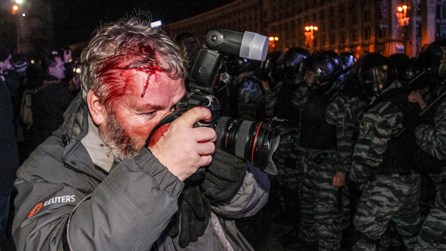 Wounded photographer at Kiev protest